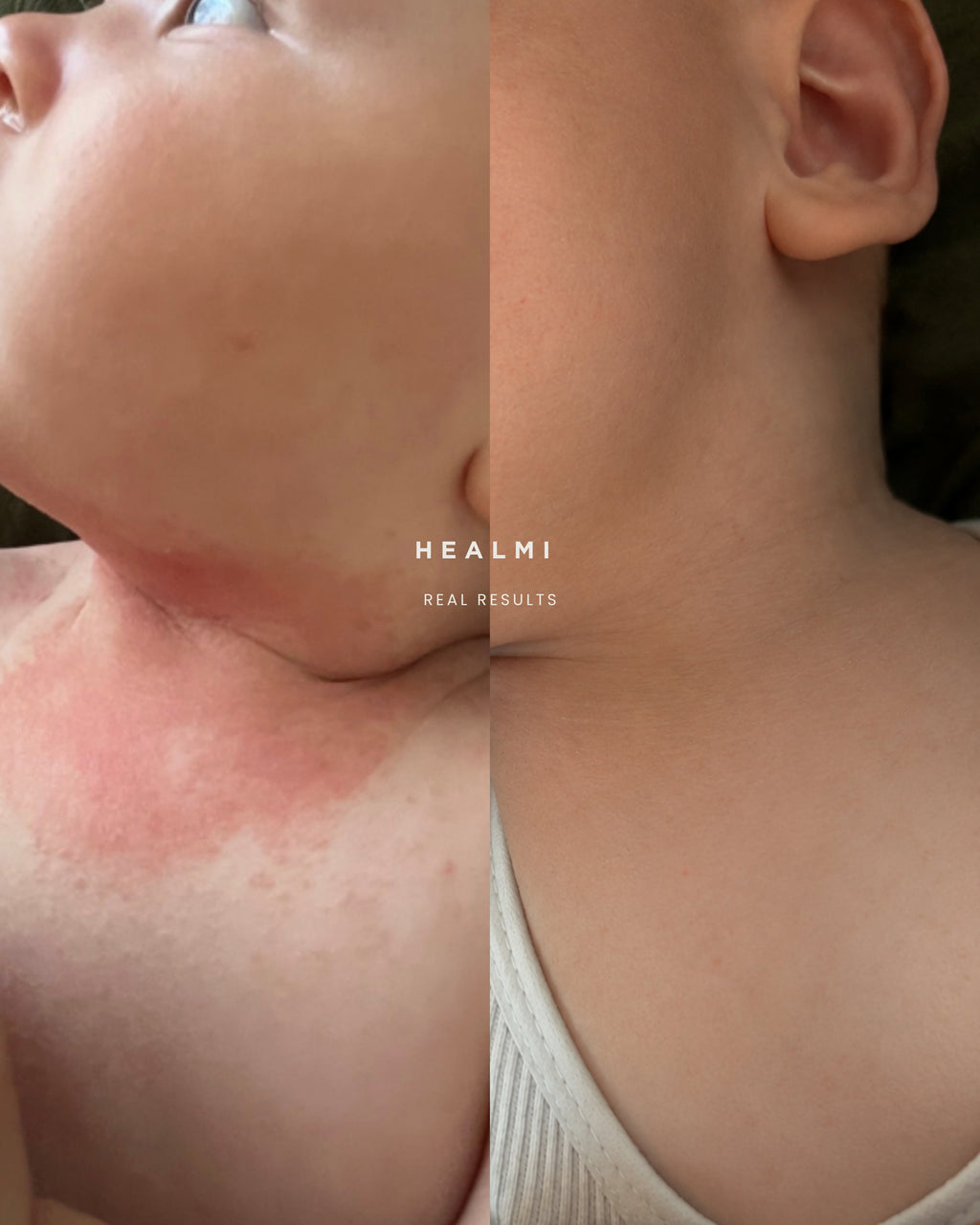 Healmi | Skin Calming Balm