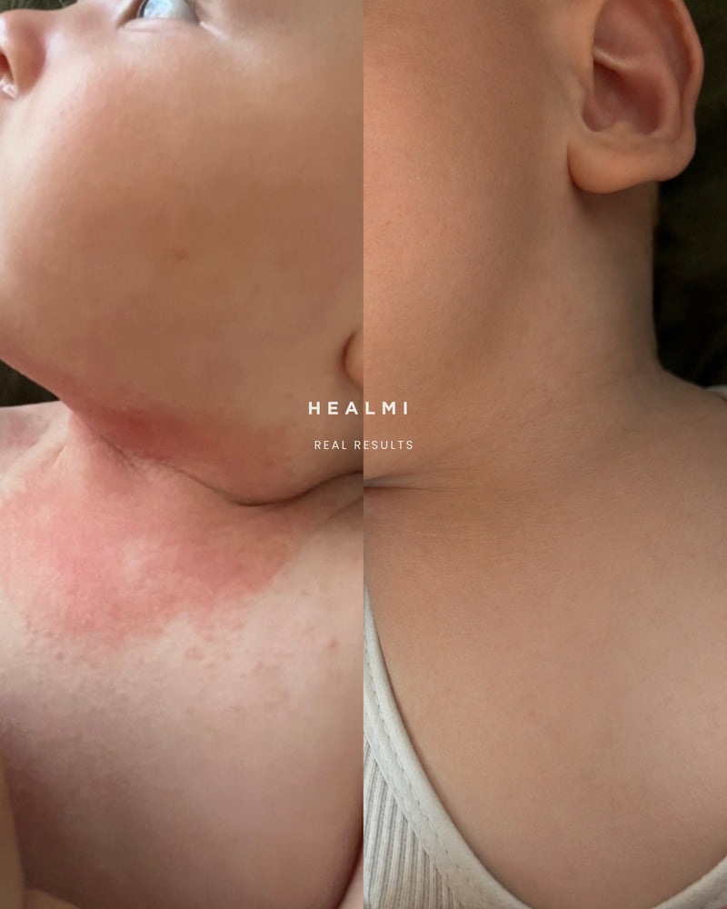 Healmi | Skin Calming Powder