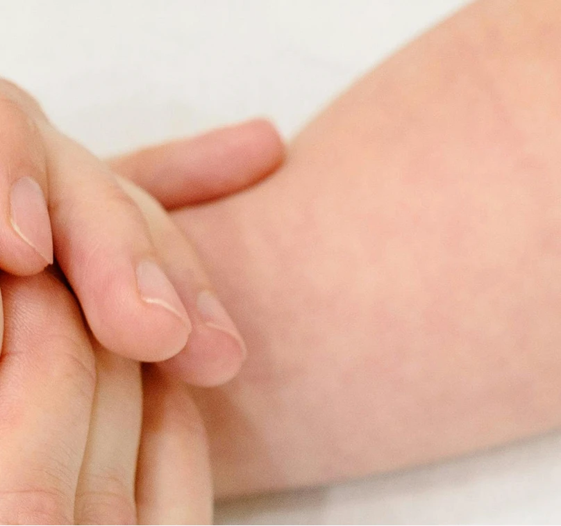 Irritation Calmed Skin